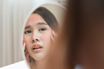 Dermatology, scratch asian young woman looking at mirror, expression worry and itch, itchy allergy or allergic sensitive reaction, red spot or rash on her face. Beauty care from skin problem treatment