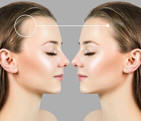 Beautiful woman before and after hair treatment.
