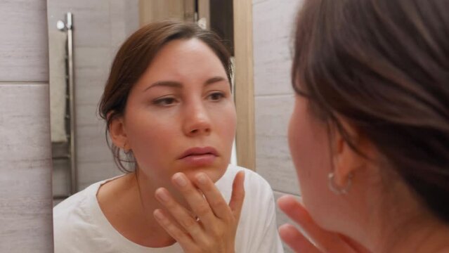 A young adult attractive woman with red sunburned skin looks at her face in the bathroom mirror. Sunburn of the skin