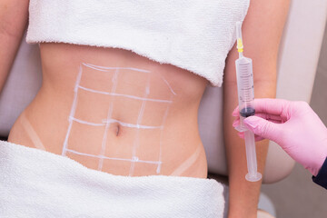 close-up photo of a woman's belly, photo of aesthetics, procedures on the abdomen. beauty clinic. ozone application, ozone therapy, enzymes, slimming. weight loss. - obrazy, fototapety, plakaty