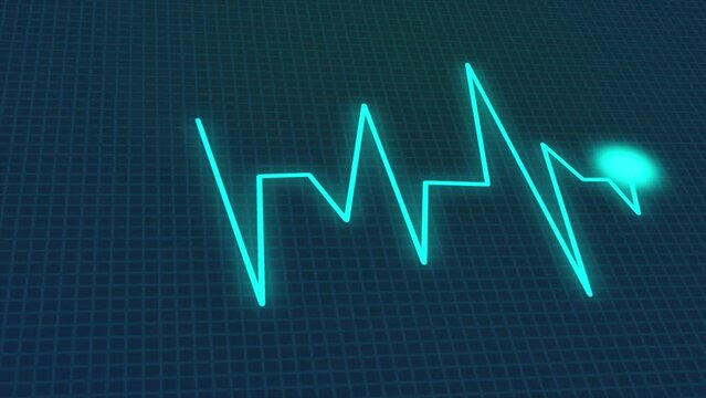 A dynamic background and a blue heart monitor line. EKG Loop Screen, 60 BPM, Blue with Grid. Electrocardiogram (EKG or ECG) or heart rate monitor loop, animated beeping at 60 beats per minute.