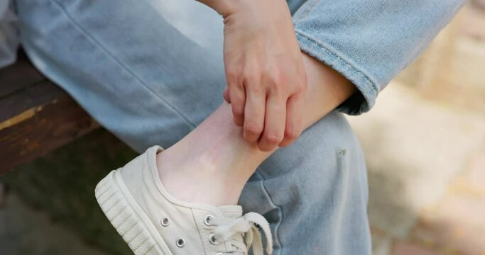 girl got mosquito bites itchy