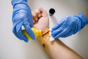 Crop doctor tending wound of patient