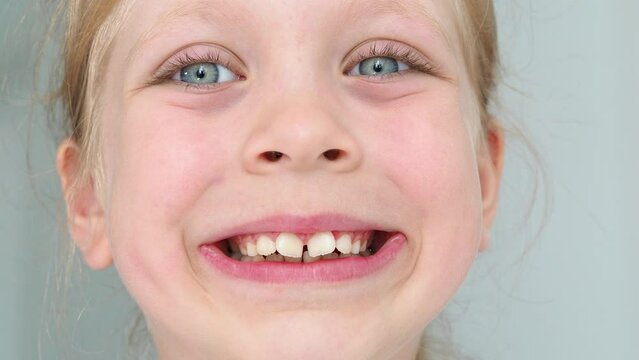 Children's dentistry. The smile of the girl is large. Child's molars. Dentistry and malocclusion. teeth large