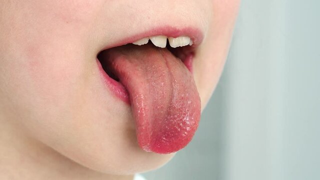 Protruding tongue of a child. macro language. Taste buds on the tongue. The baby opened its mouth and stuck out its tongue. Gymnastics for speech. Children's speech therapist