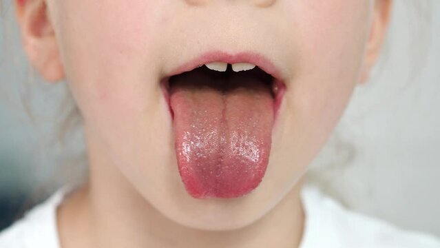 Protruding tongue of a child. macro language. Taste buds on the tongue. The baby opened its mouth and stuck out its tongue. Gymnastics for speech. Children's speech therapist