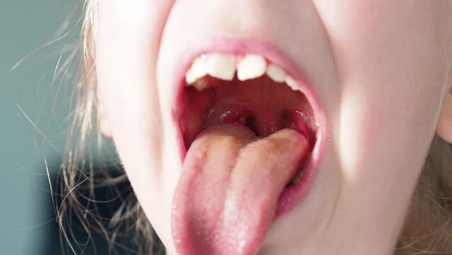 Wide open mouth with small uvula, palate and larynx. The child opened his mouth. Children's dentistry. Children's therapist, throat treatment. Overview of baby throat