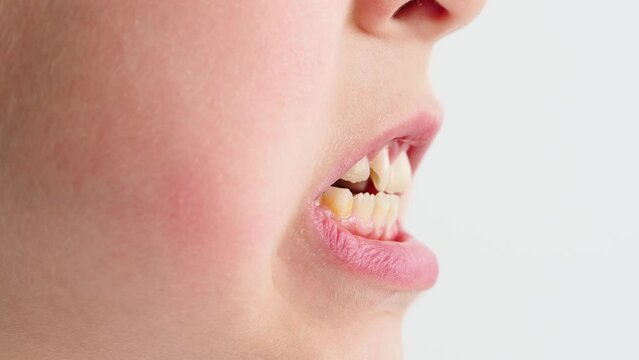 close up of a mouth with tongue. Children's bite, jaw on the side. Children's jaw and malocclusion. Teaching dentistry. Children's orthodontist and dentist.