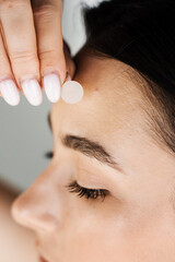 Young woman using acne patches for treatment of pimple and rosacea close-up. Facial rejuvenation...