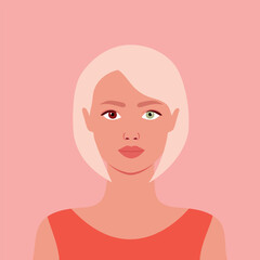 Girl with different eyes brown and green. Portrait of a female with a heterochromia. Vector illustration