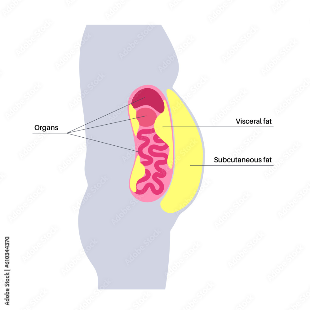 Poster Visceral fat diagram