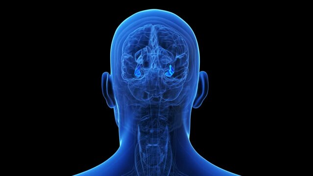 Animation of a degenerating brain