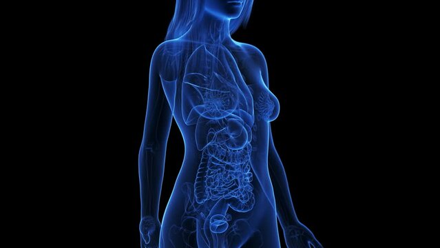 Animation of breast cancer