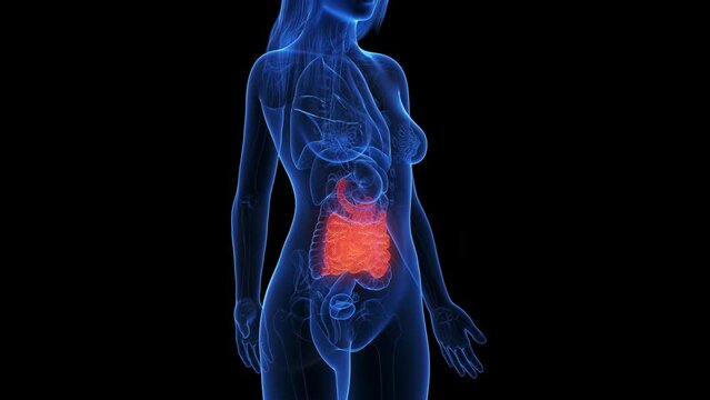Animation of an inflamed small intestine