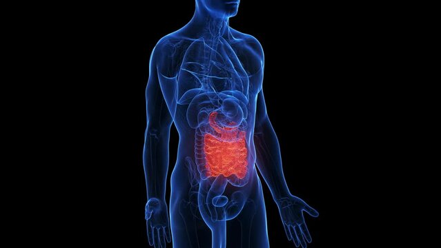 Animation of an inflamed small intestine
