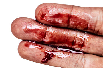 The blood stains on the hands