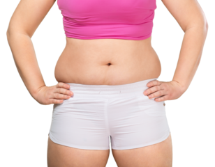 Overweight lady standing with stomach exposed