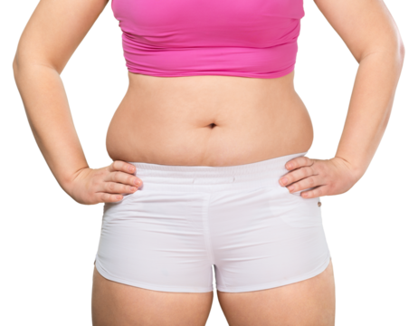 Overweight lady standing with stomach exposed