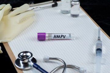 Background of Human Metapneumovirus (HMPV) RT-PCR Kit ,Medical health concept