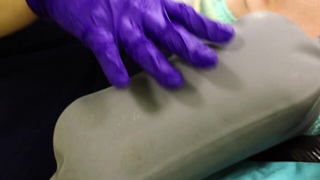 4K close-up footage of Bag Valve Mask Ventilation during cosmetic surgery. Nurse in glove and gown hand-pumping ventilation for aneesthetised lying patient in operating room stock video.   