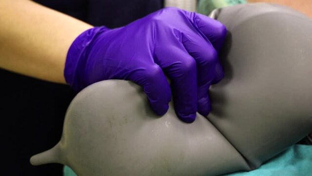 4K close-up footage of Bag Valve Mask Ventilation during cosmetic surgery. Nurse in glove and gown hand-pumping ventilation for anaesthetised lying patient in operating room stock video.   