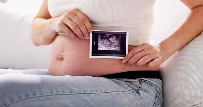 Close-up Of A Pregnant Woman With Ultrasound Photo