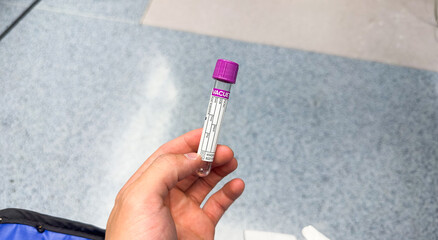 Blood tubing symbolizes medical care, diagnostics, treatment, blood work, and the vital connection between patients and healthcare professionals