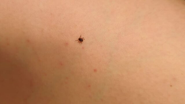 A small tick crawls over the human body on the skin. Seasonal problem of dangerous pathogens