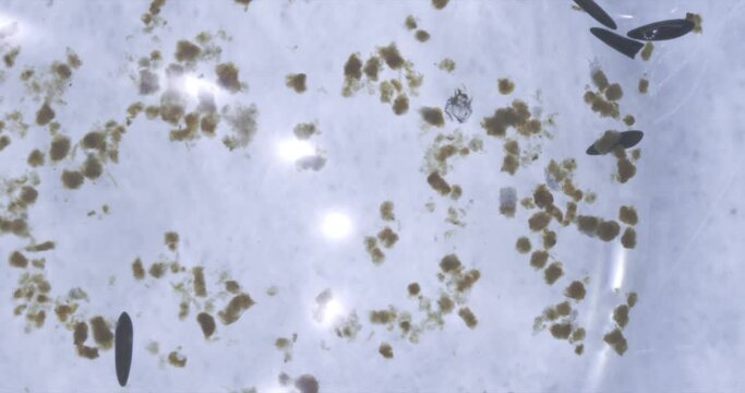 Mosquito Eggs and Larvae Macro 5X