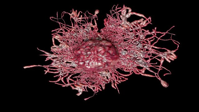 Cancer cell growth uncontrollably over tissue, Tumor infection cells and spreading, Invasive inflammation and metastasis cancerous. reproduce, duplicating, cells expanding, Disease, alpha, 3d render