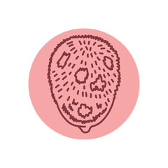 Alopecia black line icon. Autoimmune diseases