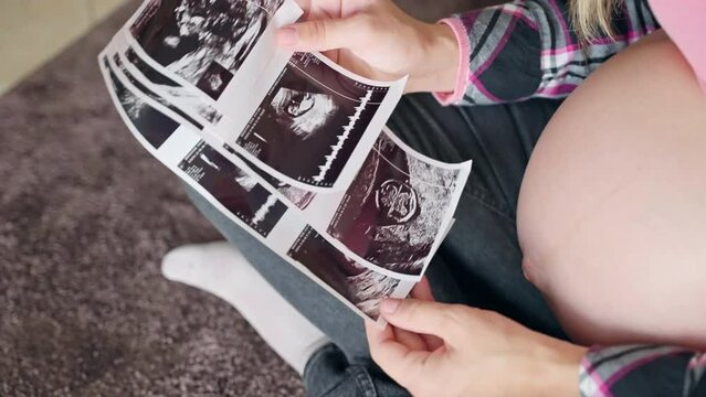 Happy mother kissing ultrasound scan pictures of her baby child, future mom showing her love and affection for her baby in tummy, beautiful prenatal period, maternity concept