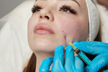 Syringe with a patient's blood plasma in a cosmetologist's hand for a plasmolifting of a woman's...
