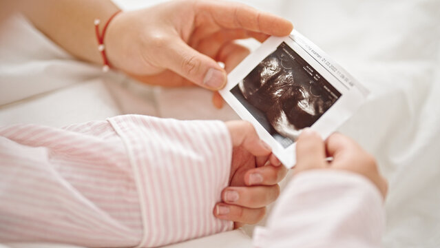 Man and woman couple holding ultrasound baby picture at bedroom