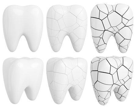 White glossy and fractured teeth set. Dentistry design elements isolated on transparent background. 3D rendered image.
