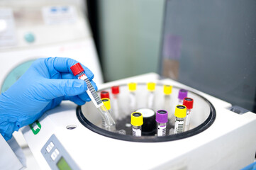 Container for tubes of biochemical analyzers Doctor removes from lab centrifuge Zika virus ZIKV
