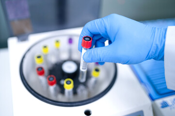 Container for tubes of biochemical analyzers Doctor removes from lab centrifuge Zika virus ZIKV