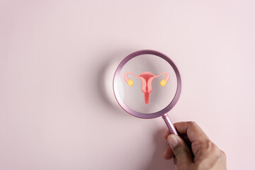 Checkup uterus reproductive system , women's health, PCOS, ovary cancer treatment and examine, Healthy feminine concept. - obrazy, fototapety, plakaty
