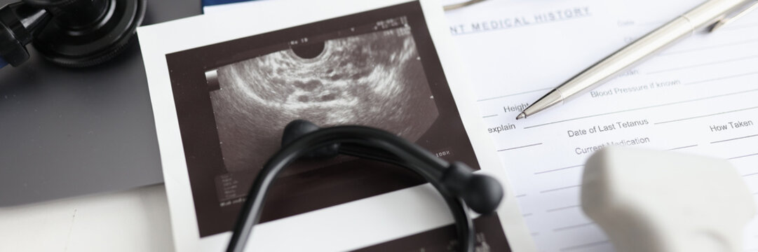 Modern ultrasound device with sensor and ultrasound of uterus. Medical chart stethoscope and ultrasound probe on table