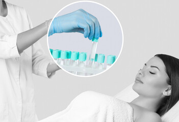 The doctor holds blood collection tubes in the cosmetology office before the Prp procedure.