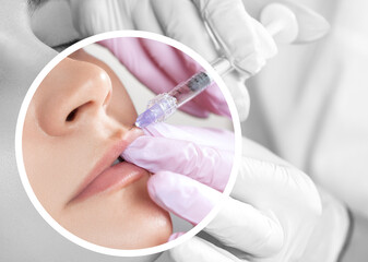 The doctor cosmetologist makes Lip augmentation procedure of a beautiful woman in a beauty salon....