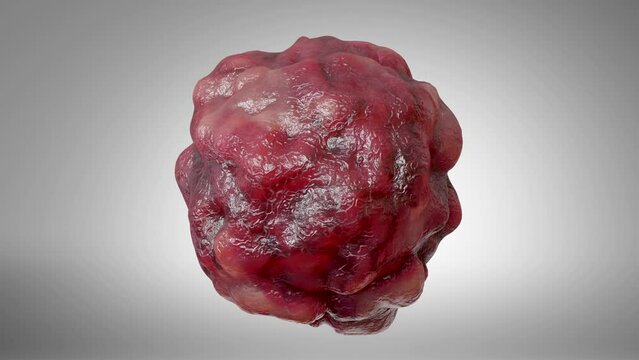 Cancer cell growth uncontrollably over tissue, Tumor infection cells and spreading, Invasive inflammation and metastasis cancerous. reproduce by duplicating, cells expanding, Disease, 3d render