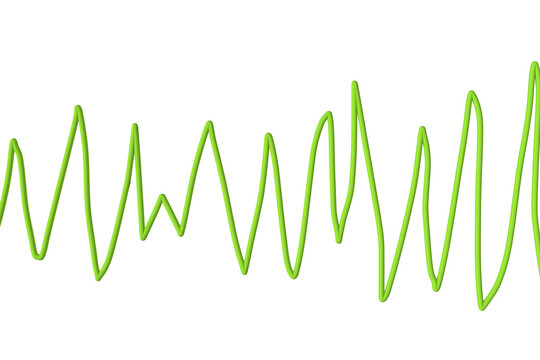 Electrocardiogram ECG displaying Torsades de pointes rhythm, 3D illustration