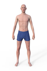 Fototapeta premium A 3D illustration of a male body with ectomorph body type