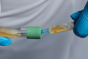 Beautician doctor's hands put test tube with blood in centrifuge container. Rejuvenation...