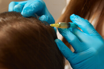Plasma treatment, plasmolifting or PRP method point the introduction of the patient's own plasma...