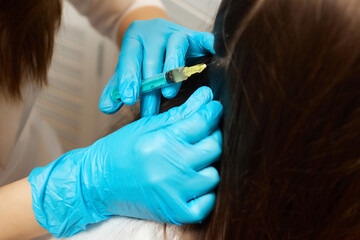 Plasma treatment, plasmolifting or PRP method point the introduction of the patient's own plasma...