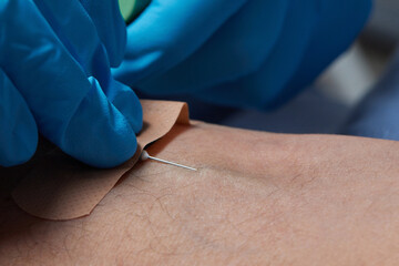 the doctor collects blood in a syringe, Nurse takes blood from the veins on the arm.
