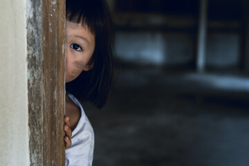 Little girl with eye sad and hopeless. Human trafficking and fear child concept.