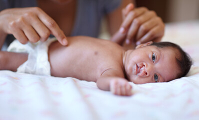 Care, portrait and a baby with a cleft palate being changed, playing and hands of a mother with...